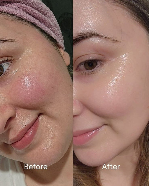 Rétinol : Le Guide Ultime pour Rajeunir votre Peau sans Irritation